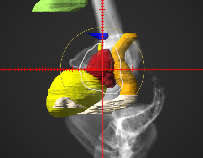 aperture_target_demo.png aperture_target_demo.png