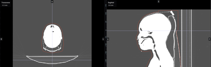 externalcontout.png externalcontout.png