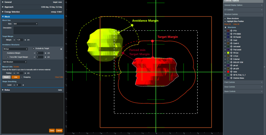 block_force_min_target_margin_on.png block_force_min_target_margin_on.png