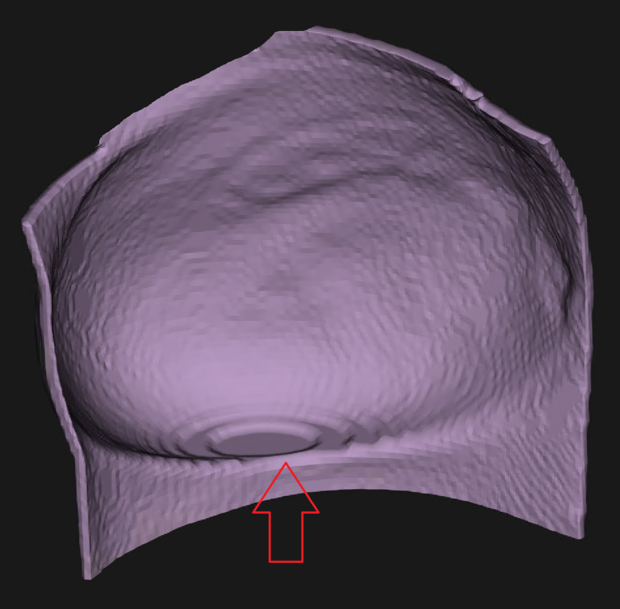 bolus57.png bolus57.png