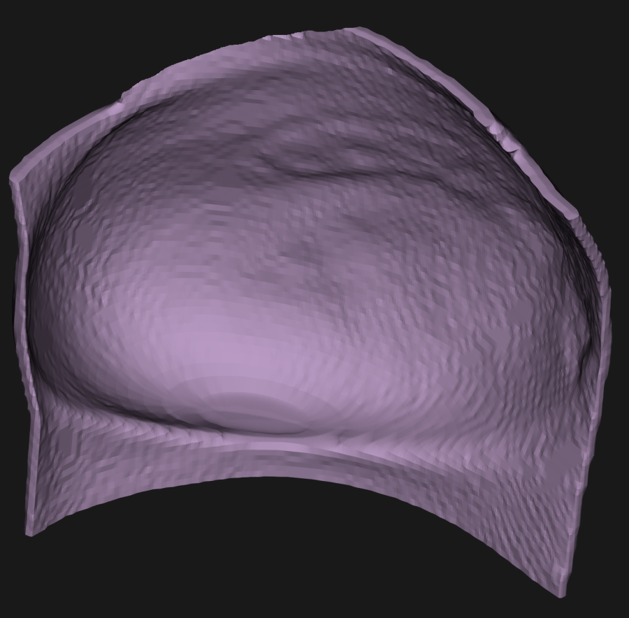 bolus58.png bolus58.png