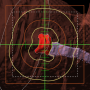 skin_collimator_avoidance_structure.png