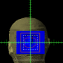 decimal_electronrt_beams_bolus_structure_full_ui.png