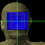 decimal_electronrt_beams_bolus_none_bev_structure.png